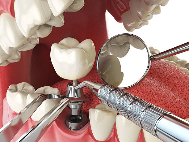 Best Orthodontic Emergency Dentist in Rolling Hills, CA